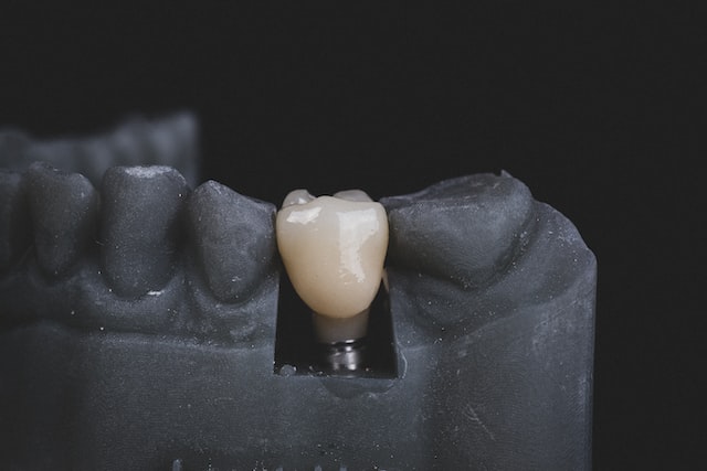 Implant zęba cena Kraków